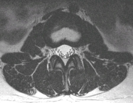 normal MRI